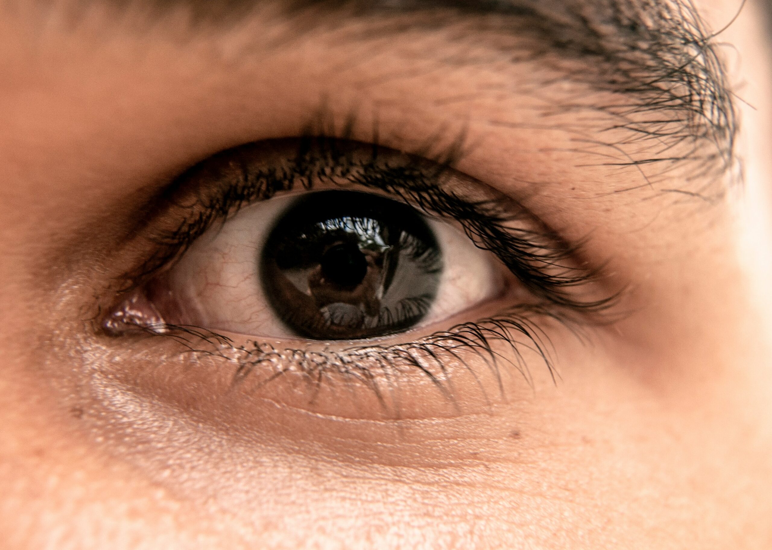 Close-up of an eye representing LASIK vision correction